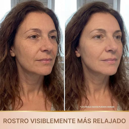 Lora – Sérum Coreano con Efecto Lifting