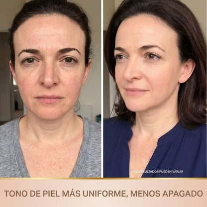 Lora – Sérum Coreano con Efecto Lifting