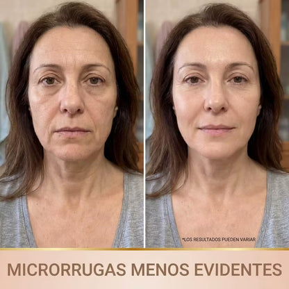 Lora – Sérum Coreano con Efecto Lifting